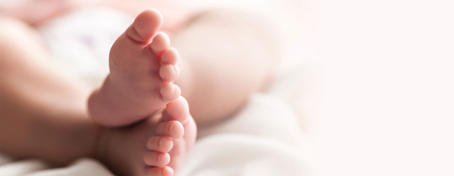 Toes of an infant who could have MoCD Type A